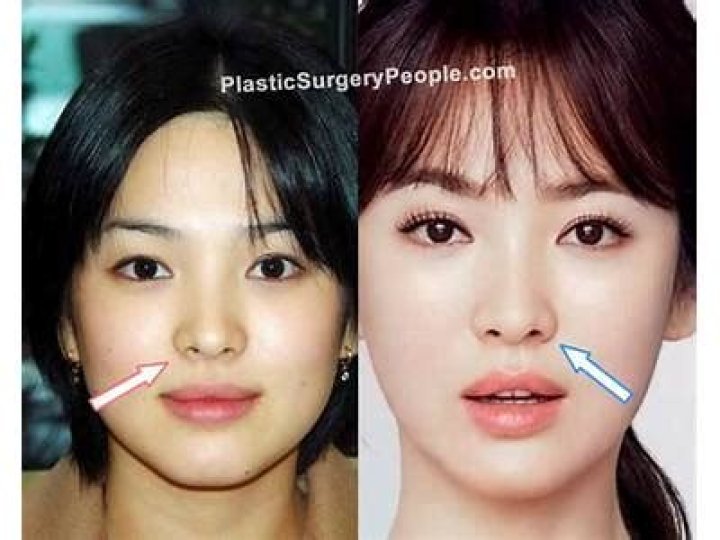 Has She Undergone Plastic Surgery?